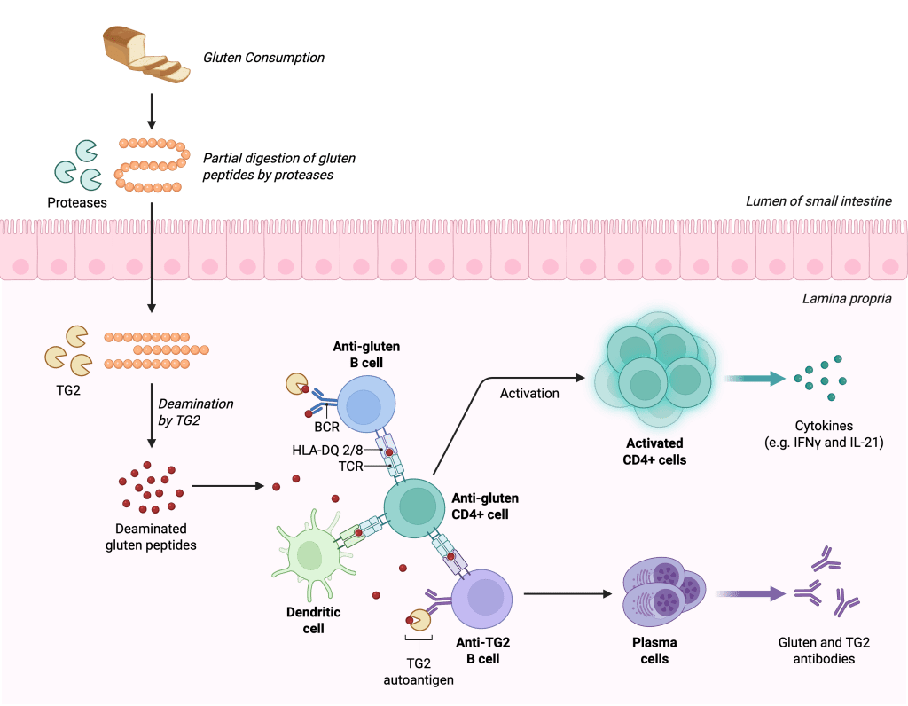 What is Celiac&nbsp;Disease?